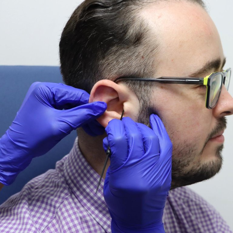 A patient having manual ear wax removal.