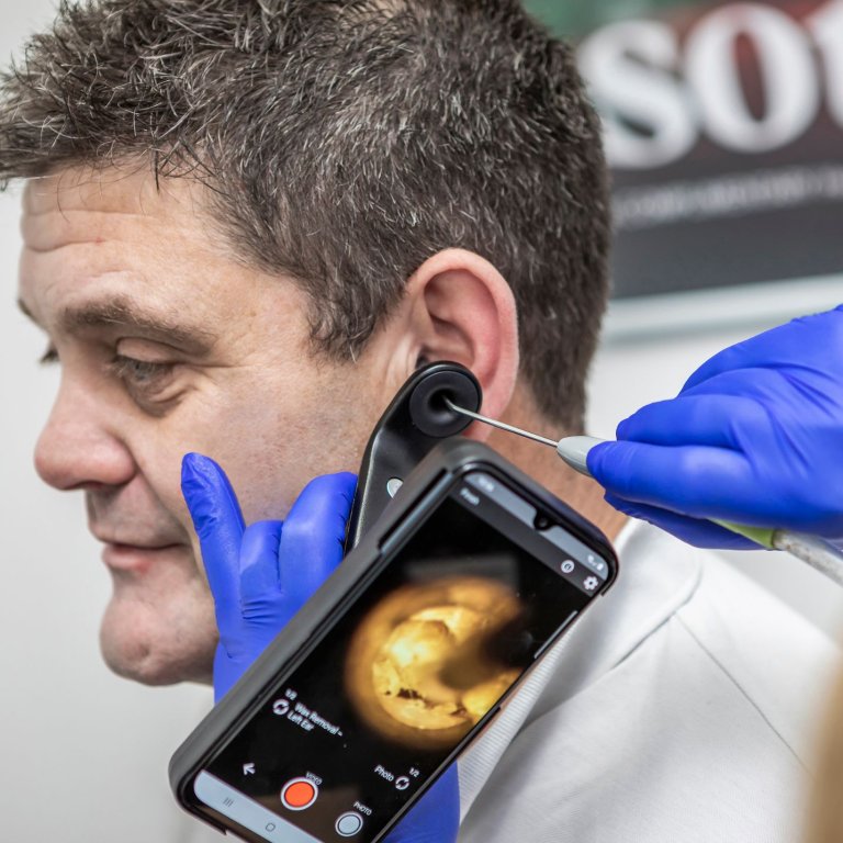 A patient having ear wax removal appointment.