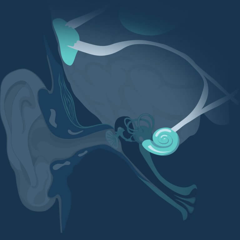 Diagram explaining the origin of tinnitus.