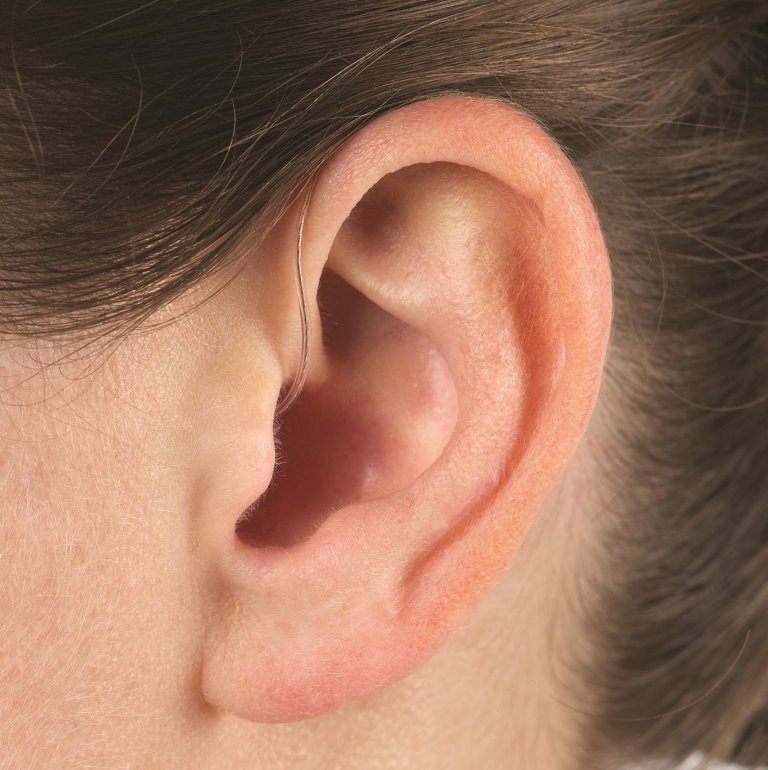 Close-up on a person's ear wearing a receiver-in-canal (RIC) hearing aid.